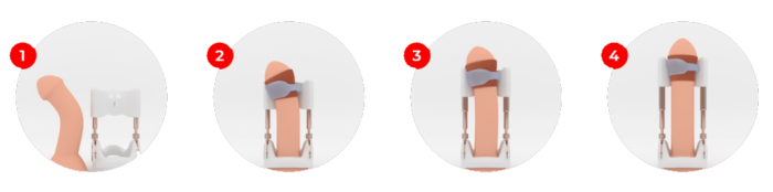 extender2.png extender2.png